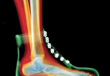 Le fardeau de la chaussure rigide : L’erreur du “maintien de cheville” qui épuise vos jambes